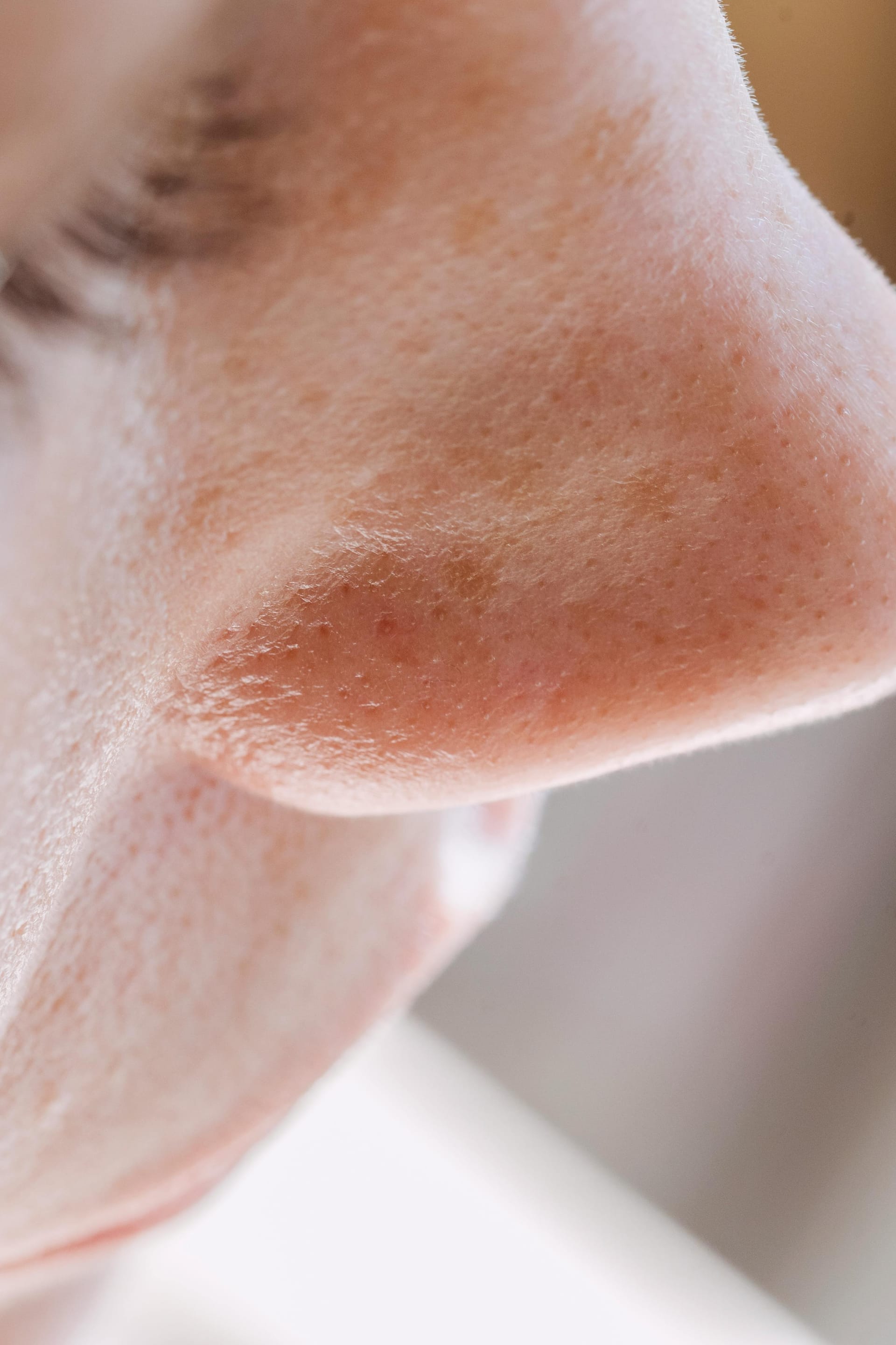 Struggling with Large Pores? Here's How To Minimise Their Appearance